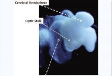 美科學(xué)家宣稱 培育出了第一個(gè)幾乎完全成型的人類(lèi)大腦